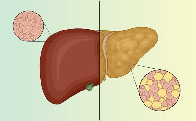 The liver cries for help