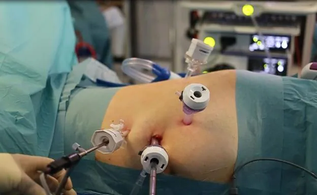 Operación de transplante de riñón