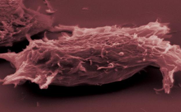 Composición de imágenes microscópicas de células cancerígenas. 