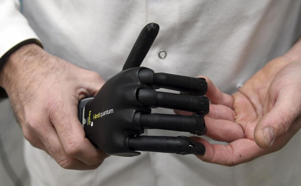 El técnico ortoprotésico Dani Rodríguez junto a la mano biónica. 