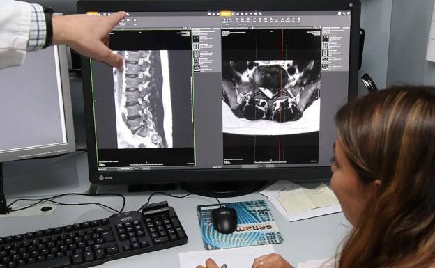 Sacyl planea llevar la radiología móvil a nuevos rincones para evitar desplazamientos al hospital