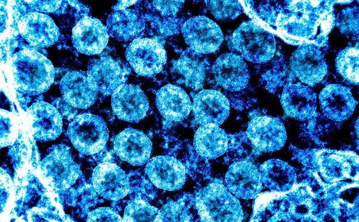 Imagen del coronavirus SARS-CoV-2, causante de la covid-19, tomada con microscopio electrónico