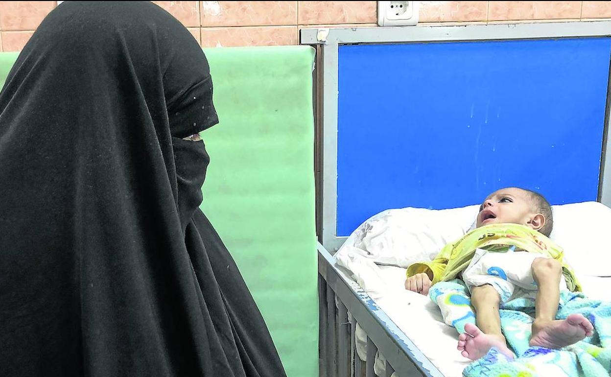 Una madre ve impotente cómo su pequeño se consume por no poder costear el tratamiento contra la desnutrición. 