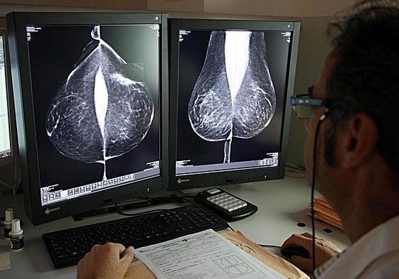 Estudio de una mamografía digital en el Hospital Río Hortega de Valladolid.