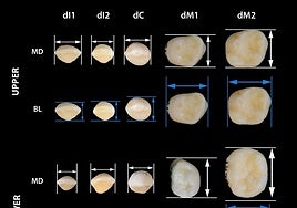 Diámetros de los dientes de leche.
