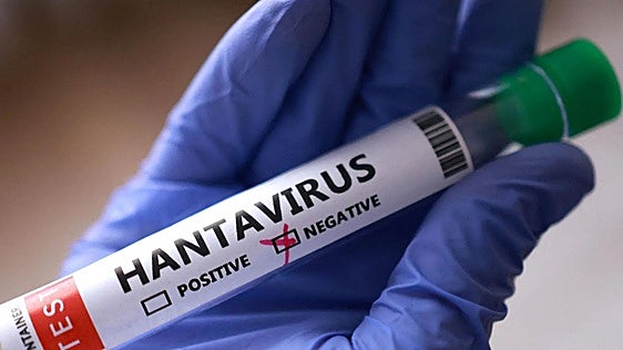 José Pedro, el vecino de Burgos en cuarentena por el hantavirus, «se encuentra bien»