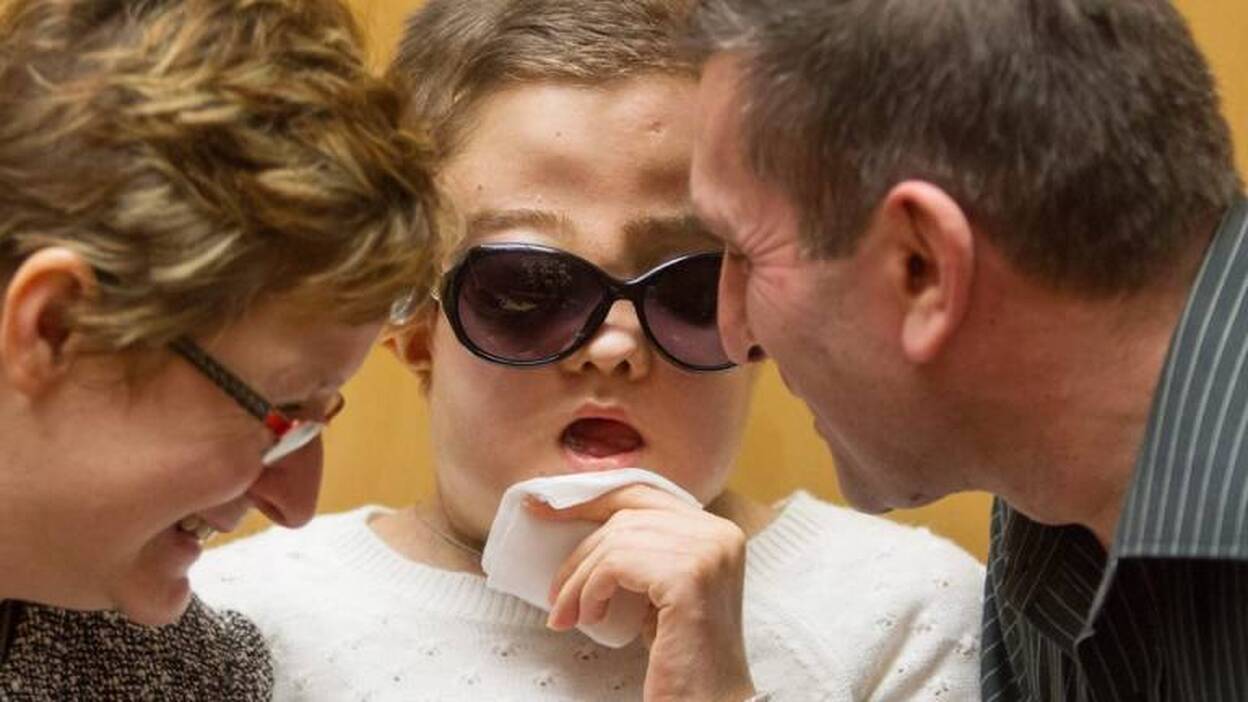 Segundo trasplante de cara en Polonia