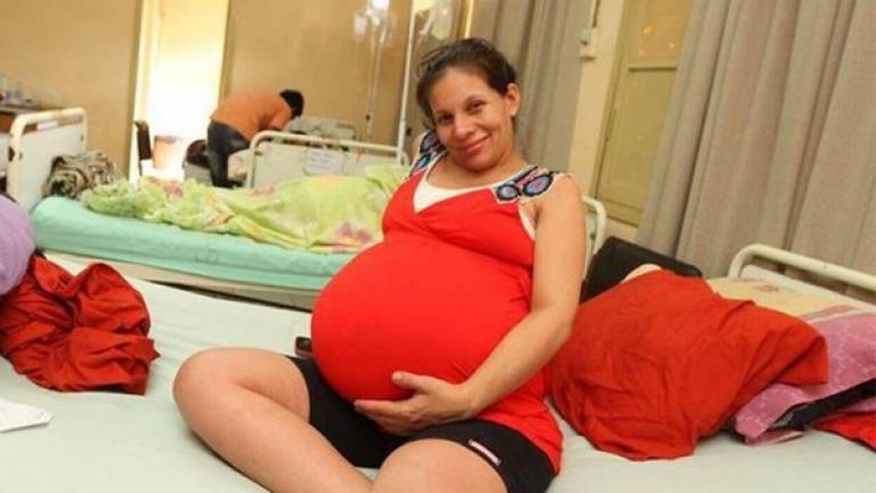 Una paraguaya da a luz a quintillizos