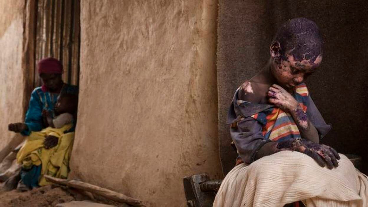 Imágenes premiadas del World Press Photo