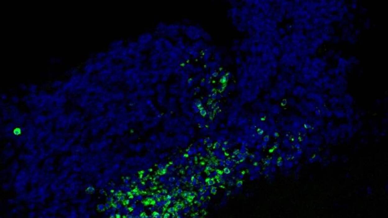 Descubren el mecanismo que utiliza el cerebro para eliminar las neuronas muertas