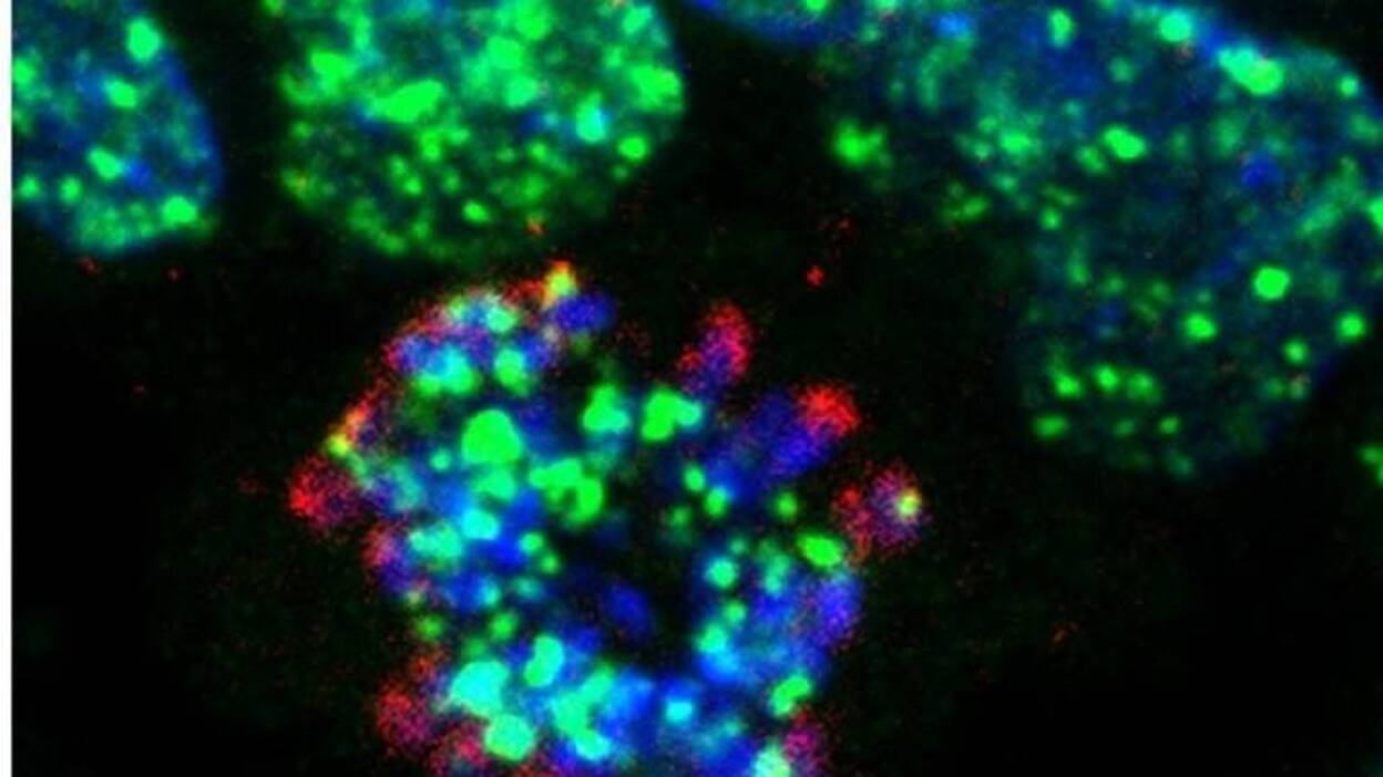 Descubierto uno de los mecanismos que genera resistencia a la quimioterapia