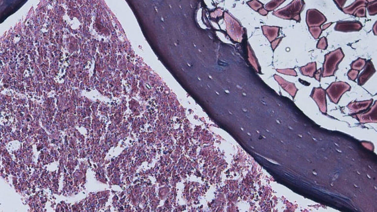 Una proteína podría potenciar la regeneración neuronal tras una lesión medular