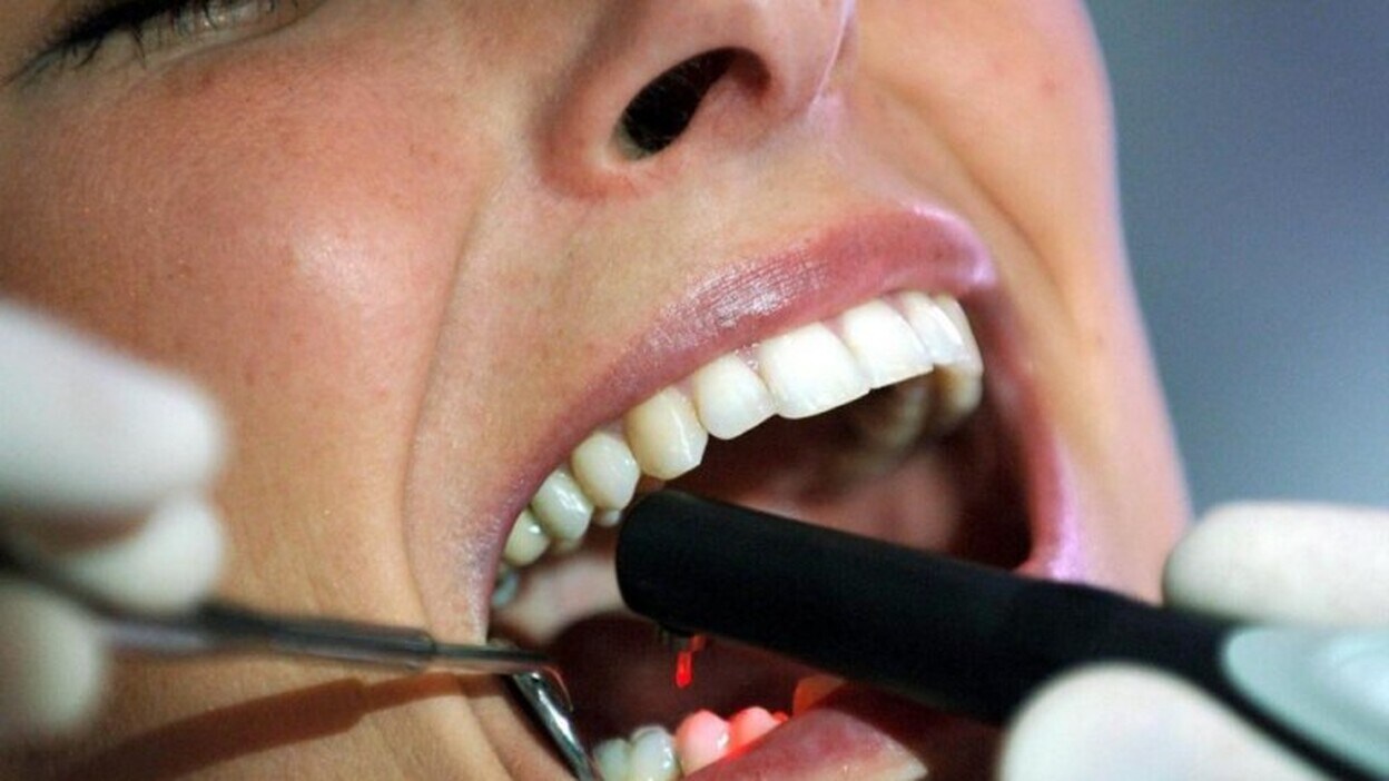 Las reclamaciones dentales en Canarias aumentan