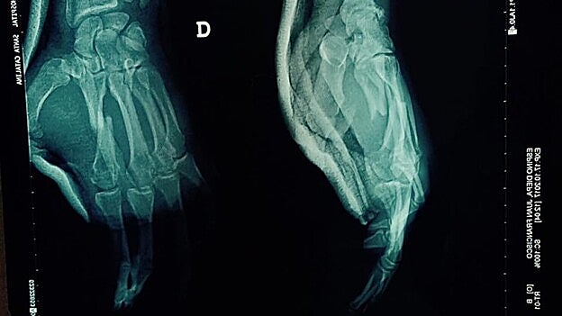Imagen de la mano dañada. /  C7