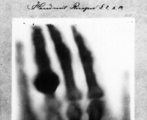 El descubrimiento de los rayos X cumple 122 años