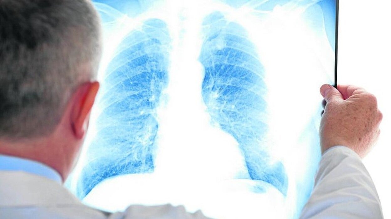Los neumólogos defienden la vacuna antigripal