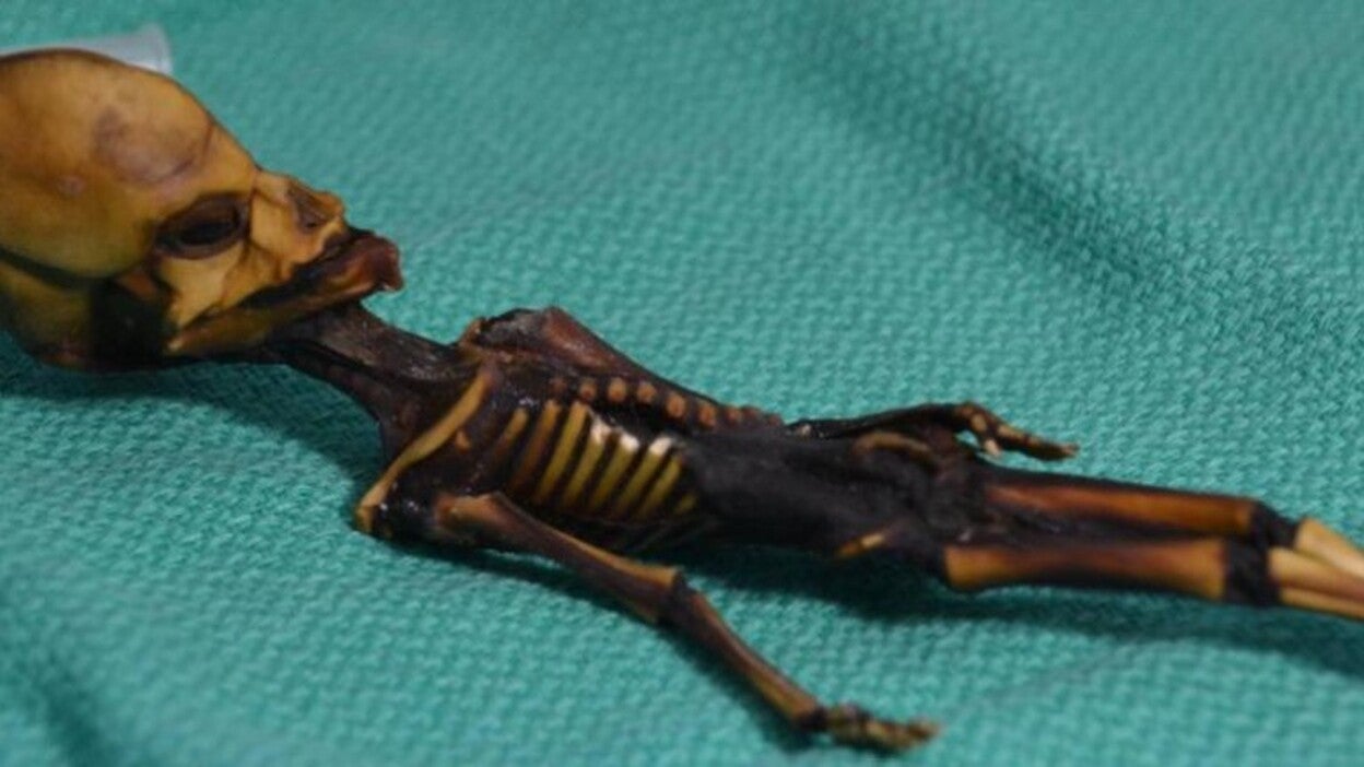El ‘alienígena’ de Atacama, un bebé con malformaciones