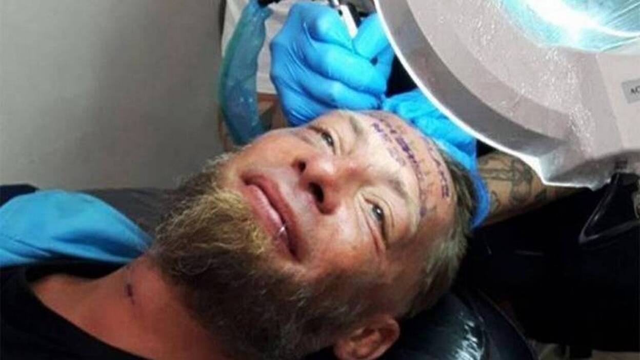 Un indigente se tatúa la frente por 100€