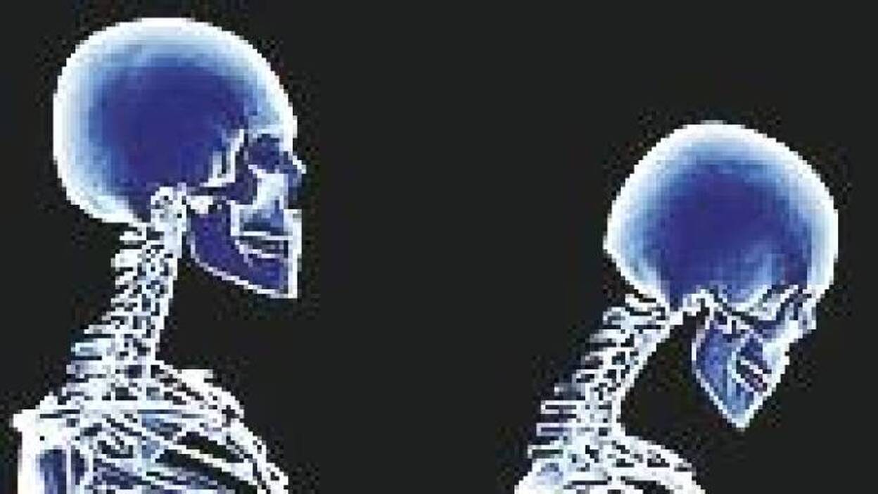 Osteoporosis, una de cada 3 mujeres mayores de 50 años sufrirá fractura por la patología