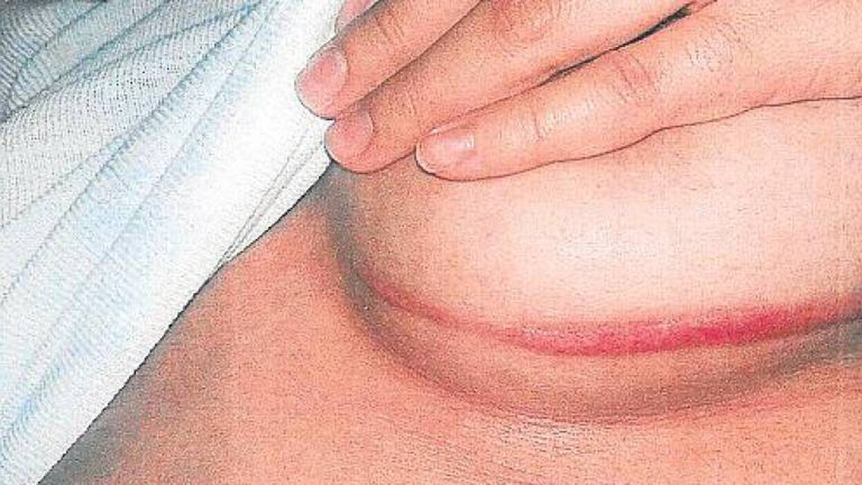 Al banquillo por querer asesinarla a cuchilladas