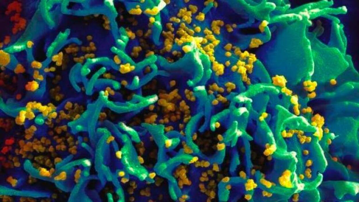 Dos de cada tres contagios de VIH en Canarias fueron en sexo entre hombres