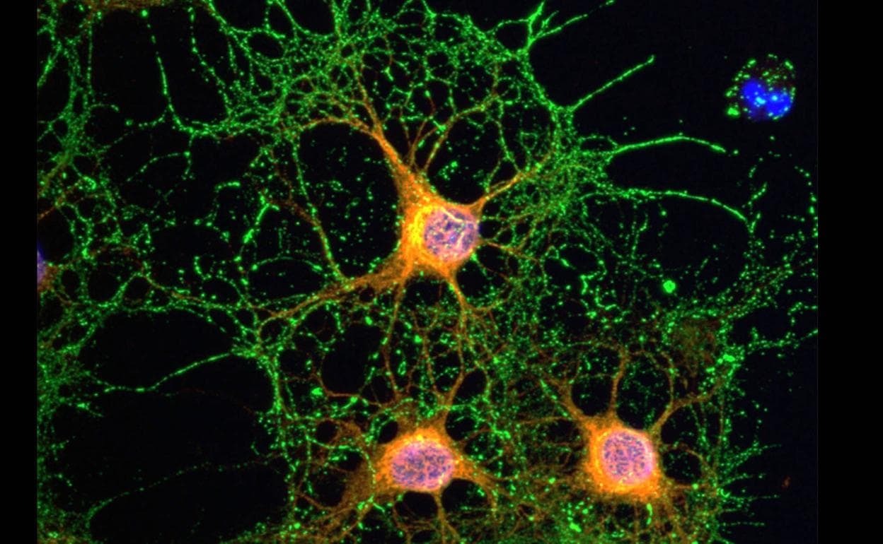 Imagen de una neurona.