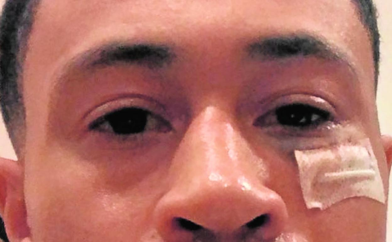 Slaughter, de regreso a casa y con un hematoma producto del codazo. 