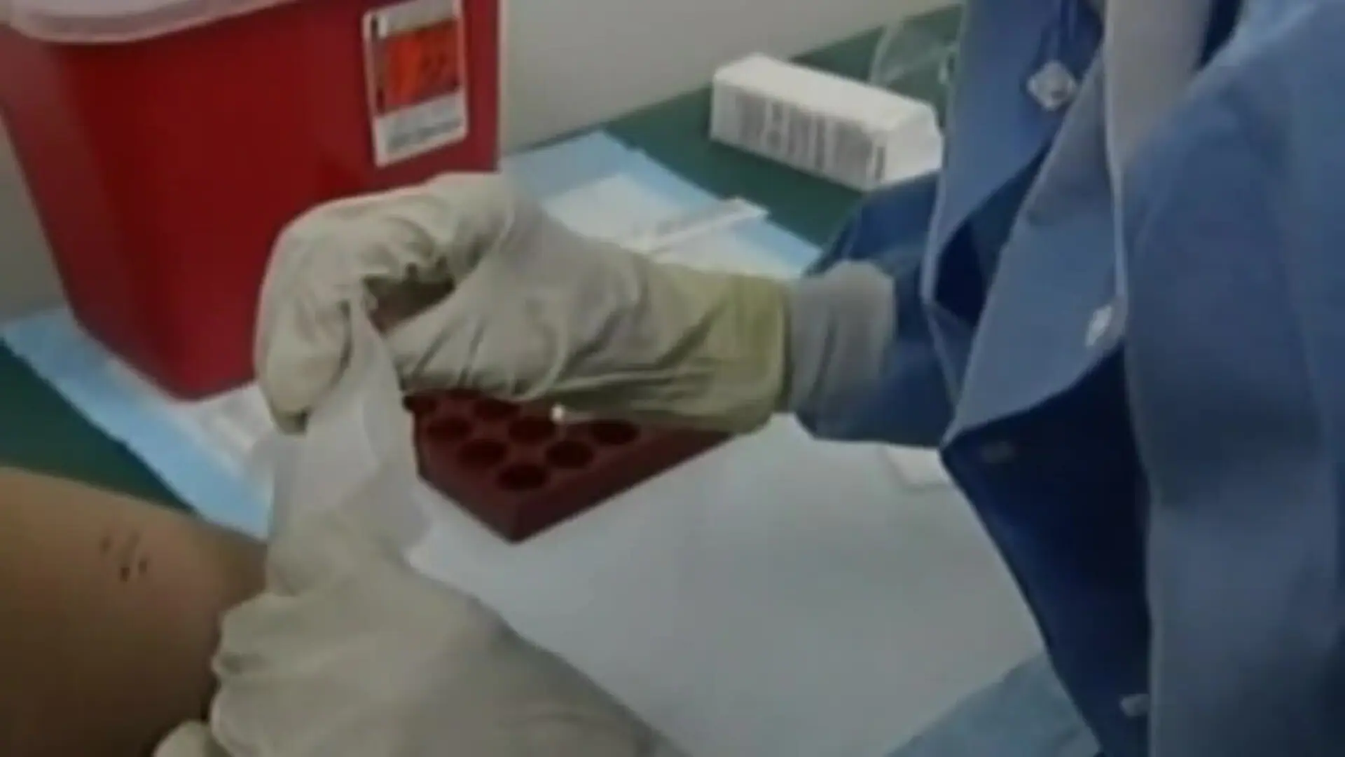 Los contagios por viruela del mono siguen aumentando y ya se plantea la compra de vacunas
