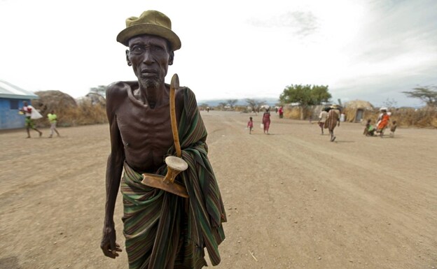 Un hombre víctima de la hambruna en el 'cuerno de África'.