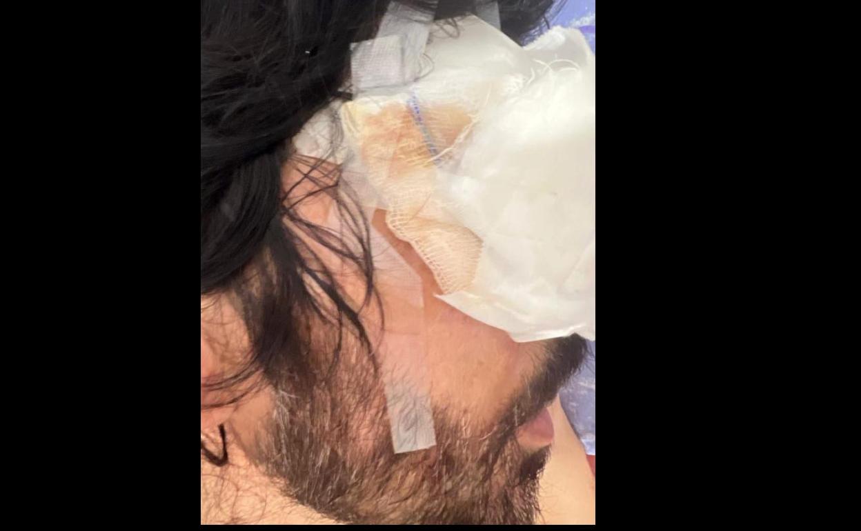 Víctima de la agresión homófoba en Costa Teguise. 