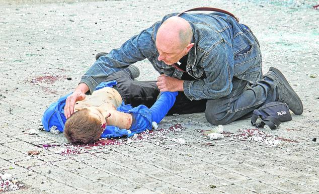 La vida de los ucranianos ha dado un vuelco con la invasión rusa. Miles de civiles muertos, casi 8 millones de refugiados, las infraestructuras del país destrozadas, daños que superan el billón de dólares.Un joven resulta herido en Ucrania debido a la invasión rusa. 