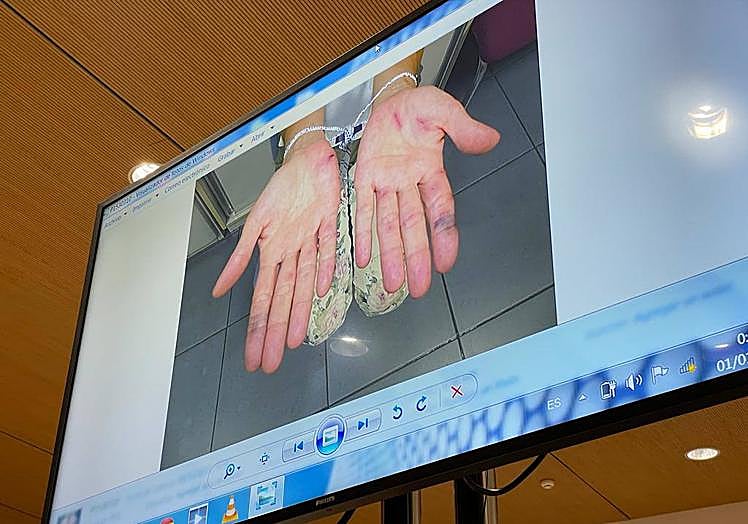 Imagen de las manos de la procesada, donde se pueden observar los cortes.