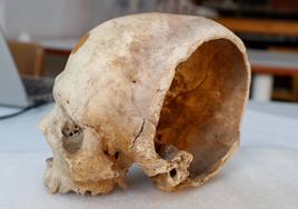 El cráneo con una herida de espada que fue estudiado en el Museo Canario.