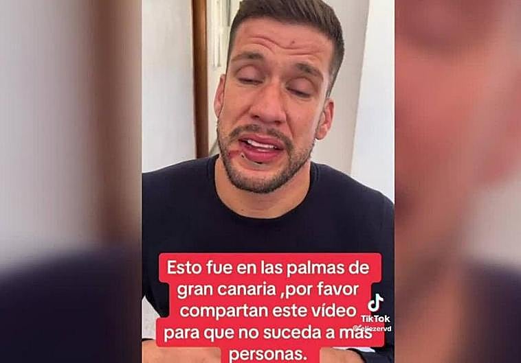 Un hombre denuncia una supuesta agresión en una discoteca de la capital grancanaria.