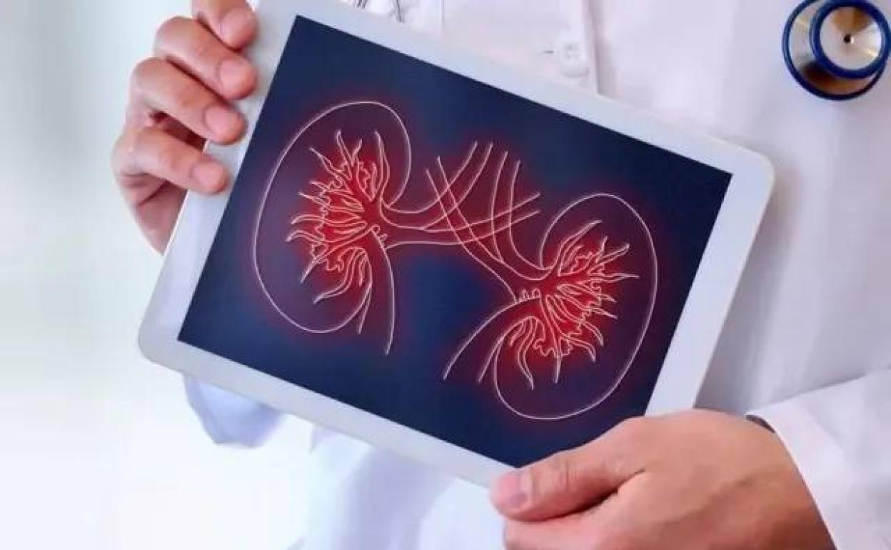 La Enfermedad Renal Crónica afecta en Canarias a más de 3.600 personas