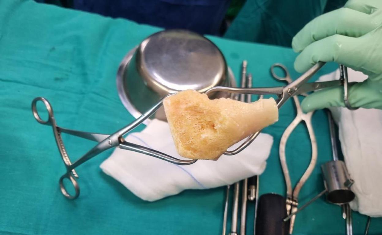 Momento de la intervención. 