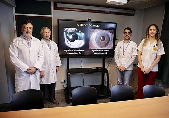 De izquierda a derecha, los doctores Francisco Cabrera, Julio Pérez, Eduardo Jerez e Isabel Guedes.