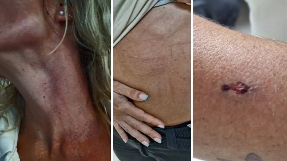 Denuncian una agresión a dos trabajadoras del centro penitenciario Las Palmas II