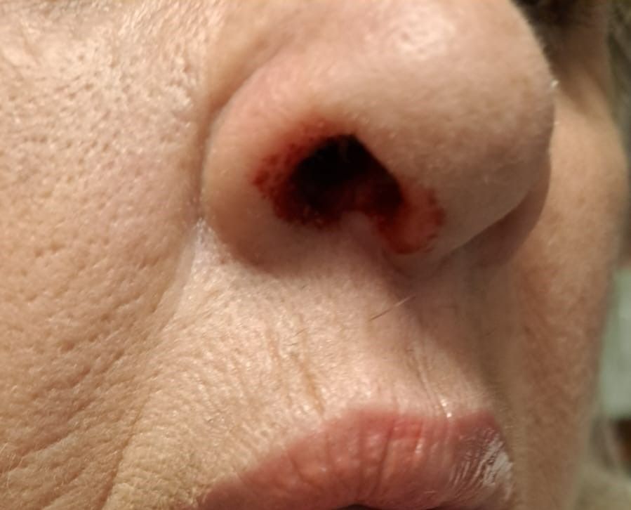 La afectada sufrió heridas en la nariz.
