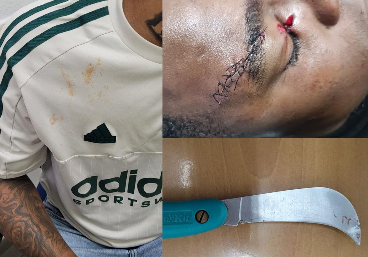 Imágenes de lo sucedido en la pasada noche.