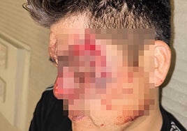 Imagen de la víctima tras el asalto.