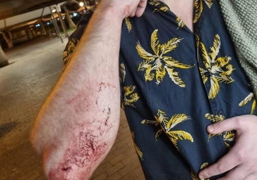 Tres jóvenes golpean y roban a un inglés en Guanarteme