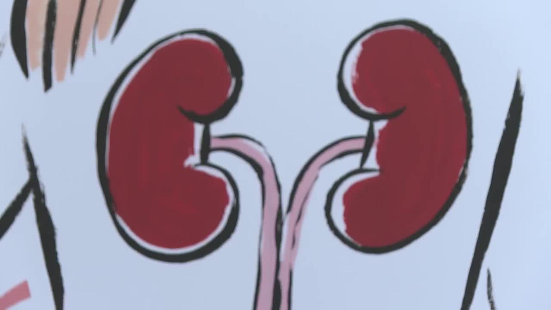 Hospitales y artistas se unen para visibilizar la relación Cardiovascular-Renal-Metabólica