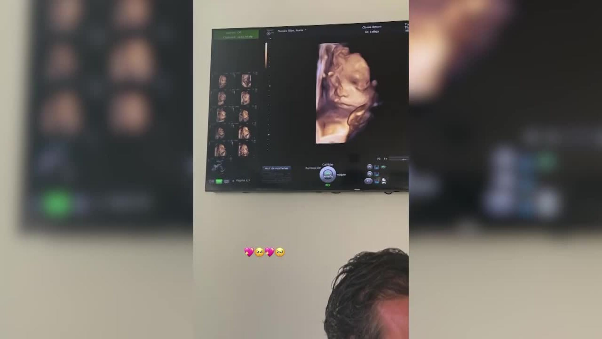 María Pombo se encuentra muy cansada por los síntomas de su tercer embarazo