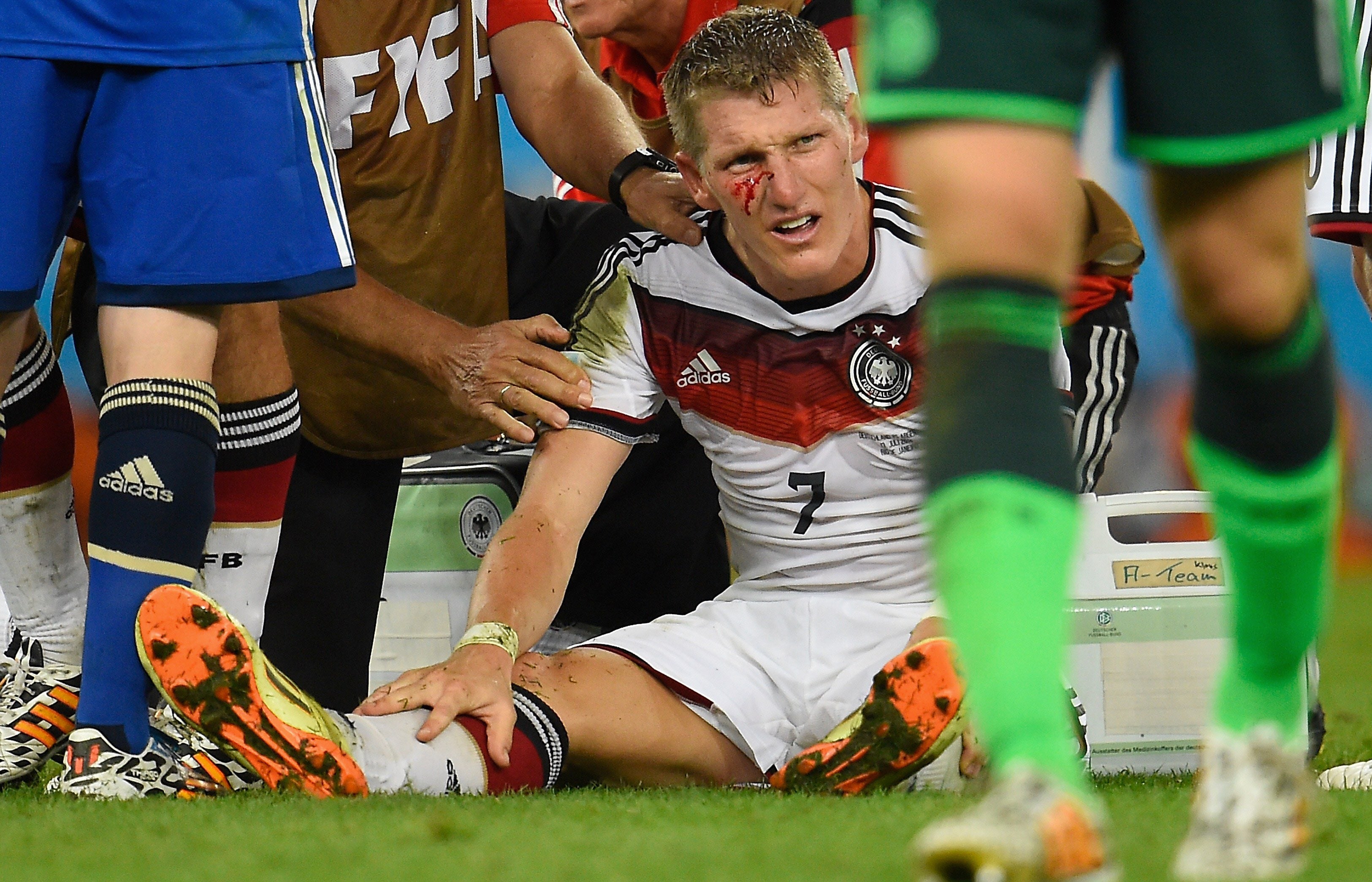 Schweinsteiger, con una brecha en el pómulo, tras un golpe del argentino Agüero.