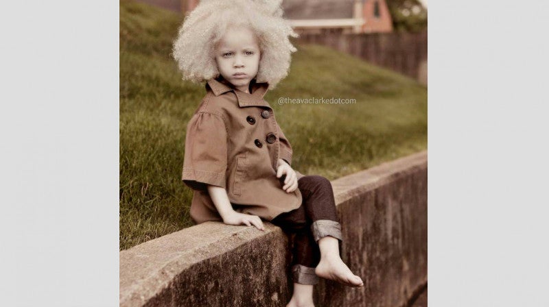 Ava Clarke, la niña negra albina que enamora en la red