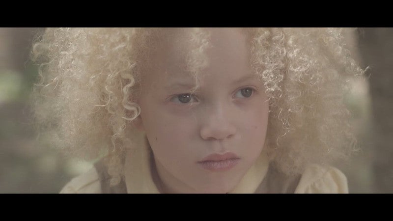 Ava Clarke, la niña negra albina que enamora en la red