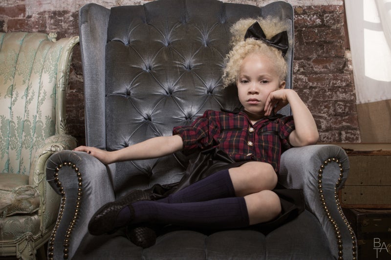 Ava Clarke, la niña negra albina que enamora en la red