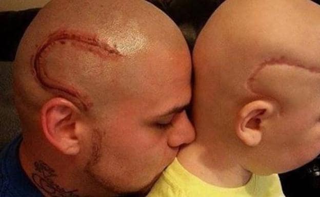 Muere Gabriel Marshall, el niño con cáncer cuyo padre se tatuó su misma cicatriz