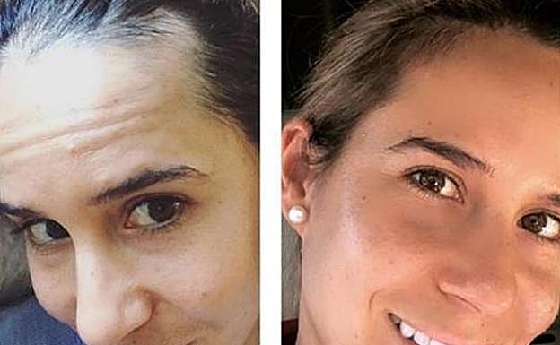 Con estas imágenes anunció Muñoz que sufría la enfermedad de Hashimoto